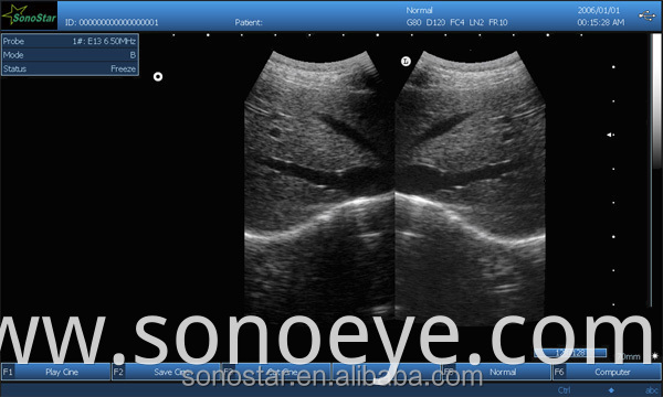 image for labtop ultrasound